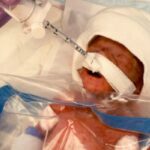 Micuțul miracol: cum a fost salvat un bebeluș prematur cu o pungă de sandviș